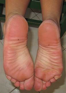 White Soles
